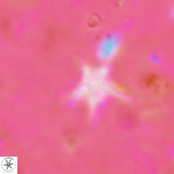 Discoaster asymmetroivrachiones VR 17851
