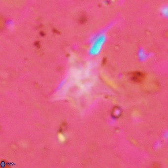 Discoaster asymmetroivrachiones VR 17853