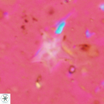 Discoaster asymmetroivrachiones VR 17853