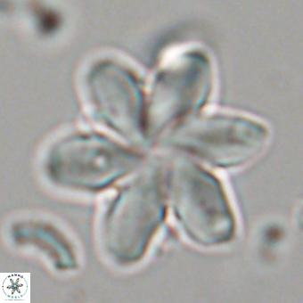 Discoaster backmanii 70820