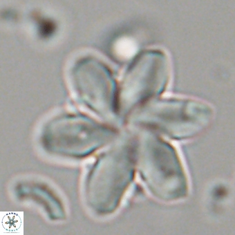 Discoaster backmanii 70821