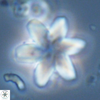 Discoaster backmanii 70822