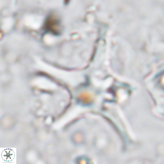 Discoaster bengalica VR 17556