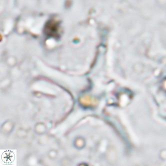 Discoaster bengalica VR 17558