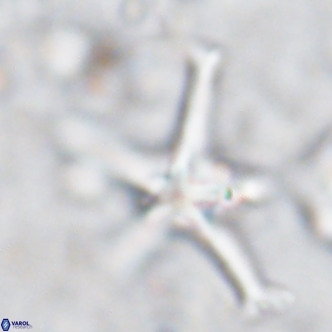 Discoaster bengalica VR 17559