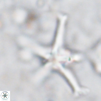 Discoaster bengalica VR 17559