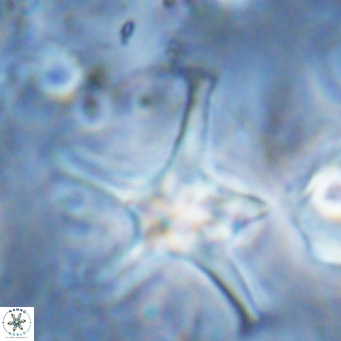Discoaster bengalica VR 17562