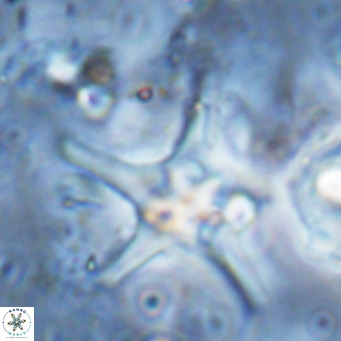 Discoaster bengalica VR 17564