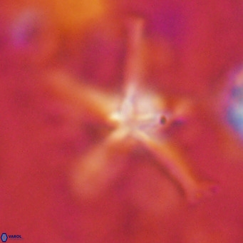 Discoaster bengalica VR 17569