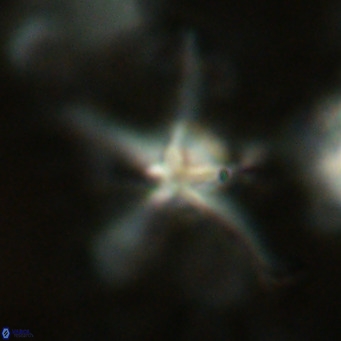 Discoaster bengalica VR 17570