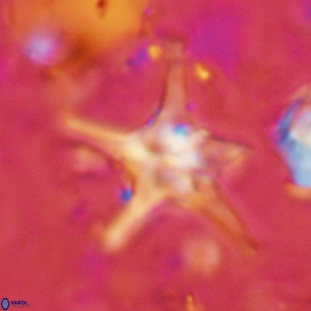 Discoaster bengalica VR 17571