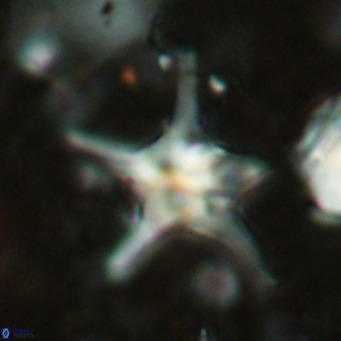 Discoaster bengalica VR 17572