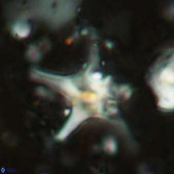 Discoaster bengalica VR 17573