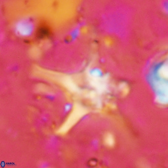 Discoaster bengalica VR 17574