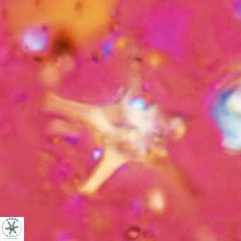 Discoaster bengalica VR 17574