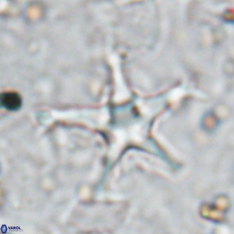 Discoaster bengalica VR 17576