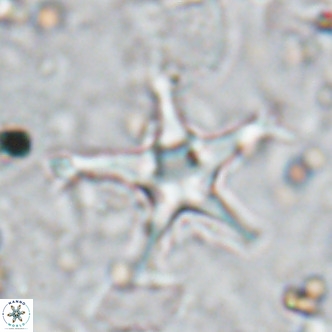 Discoaster bengalica VR 17576