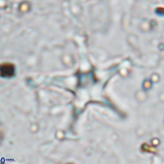 Discoaster bengalica VR 17577