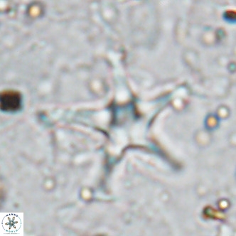 Discoaster bengalica VR 17577
