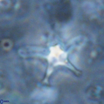 Discoaster bengalica VR 17581