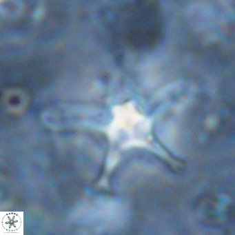 Discoaster bengalica VR 17581