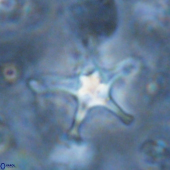 Discoaster bengalica VR 17583