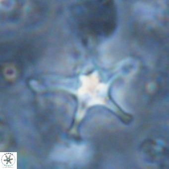 Discoaster bengalica VR 17583