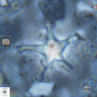 Discoaster bengalica VR 17584