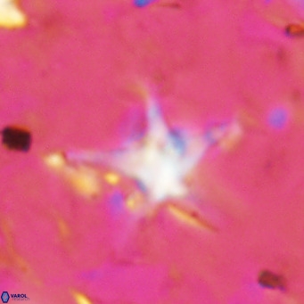 Discoaster bengalica VR 17590