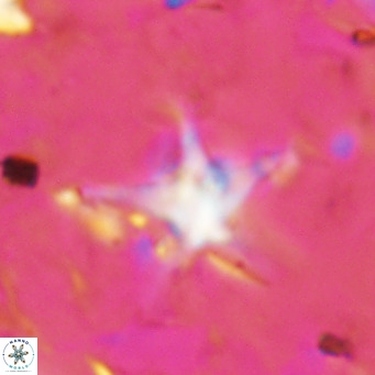 Discoaster bengalica VR 17590