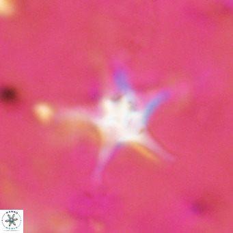 Discoaster bengalica VR 17591