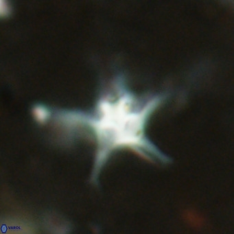 Discoaster bengalica VR 17592