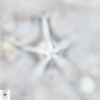 Discoaster bengalica VR 17598