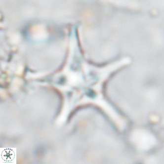 Discoaster bengalica VR 17599