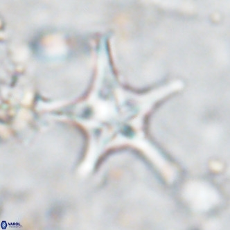 Discoaster bengalica VR 17622