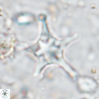 Discoaster bengalica VR 17600
