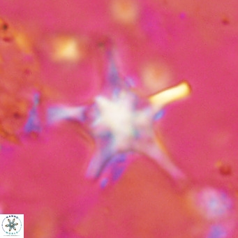 Discoaster bengalica VR 17610