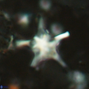 Discoaster bengalica VR 17611