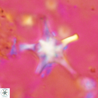 Discoaster bengalica VR 17613
