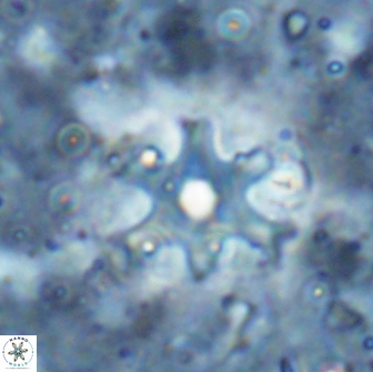 Discoaster bollii brevibrachium 19409