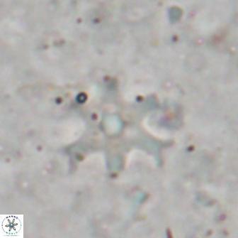Discoaster bollii brevibrachium 19410