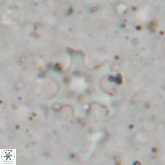 Discoaster bollii brevibrachium 19411