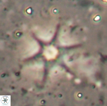 Discoaster bollii 1555