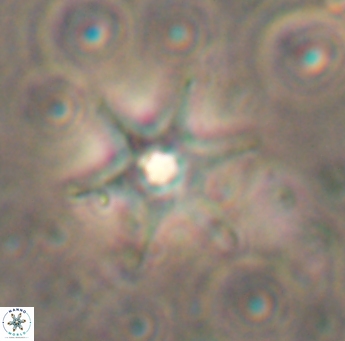 Discoaster bollii 1557