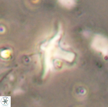 Discoaster bollii 1558
