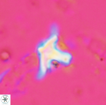 Discoaster bollii 1560