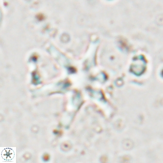 Discoaster bollii 29364