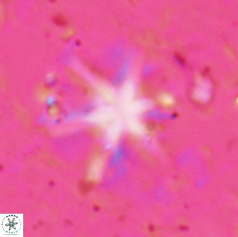 Discoaster bollii 29366