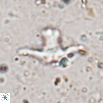 Discoaster bollii 29330