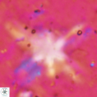 Discoaster bollii 29481